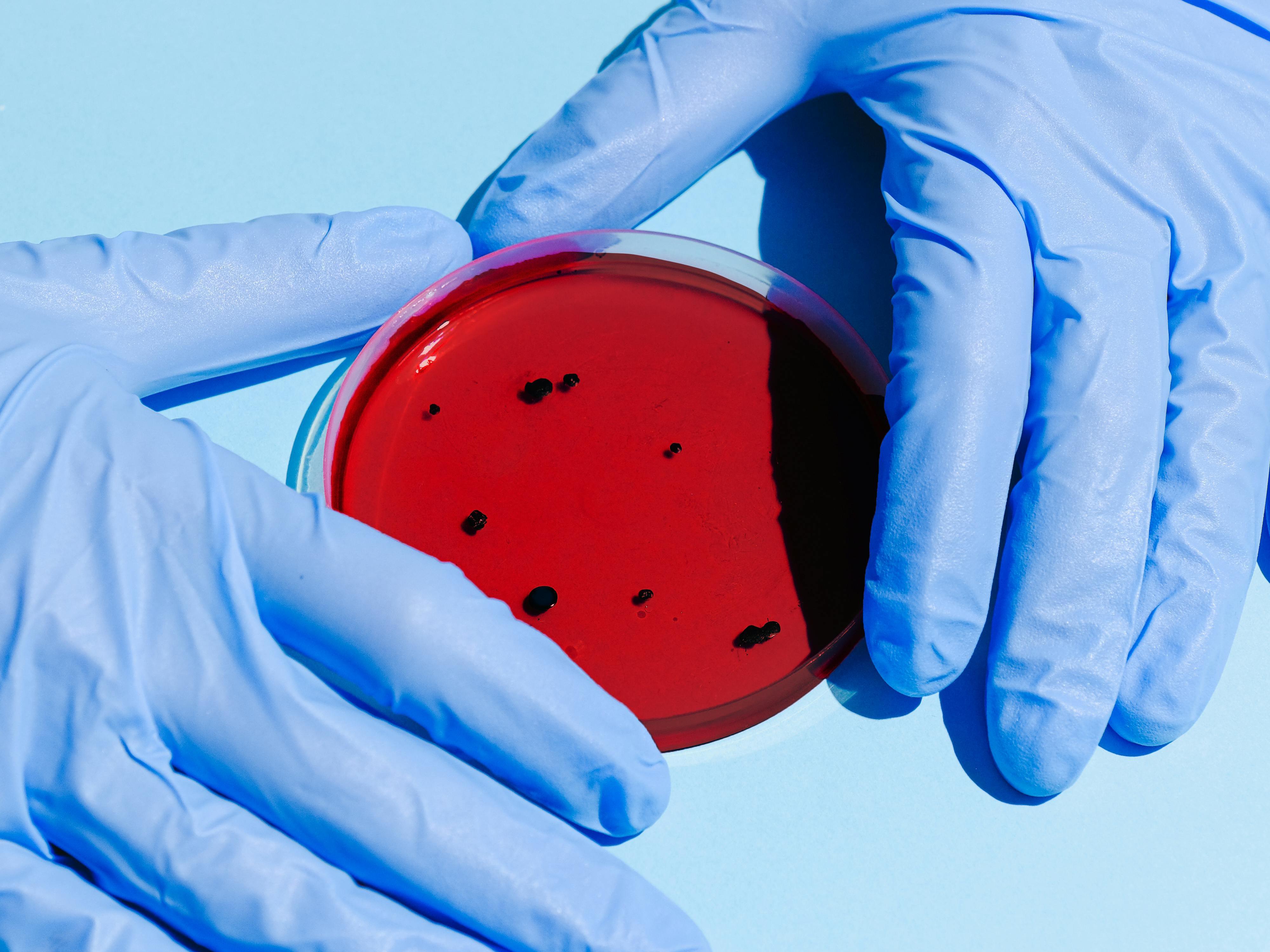 Gloved Hands Holding a Petri Dish